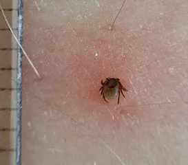 Tekenbeet en EM keramische kralen